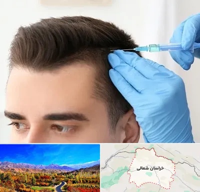 مزوتراپی مو در خراسان شمالی
