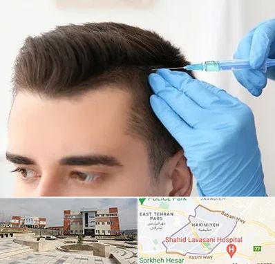 مزوتراپی مو در حکیمیه