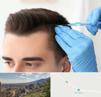 مزوتراپی مو در بوکان تهران