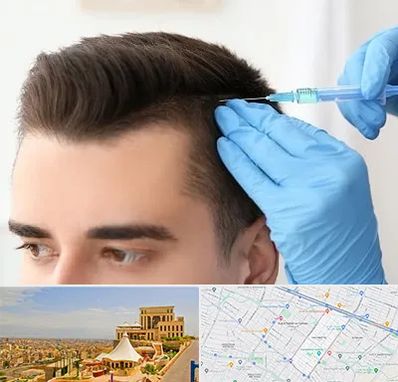 مزوتراپی مو در هاشمیه مشهد