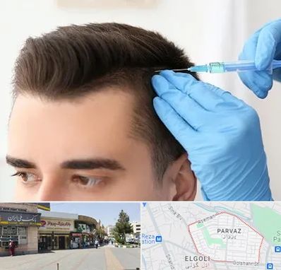 مزوتراپی مو در پرواز تبریز