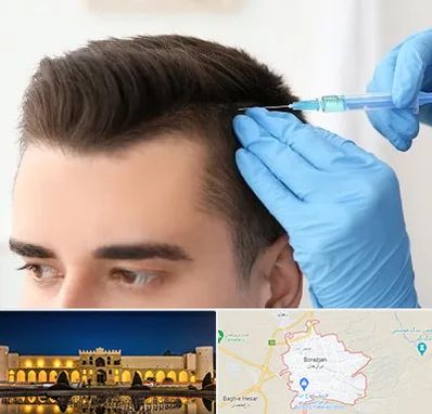 مزوتراپی مو در برازجان