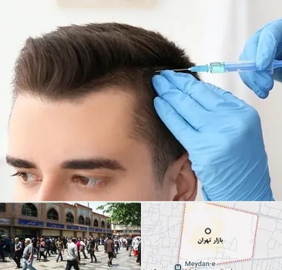 مزوتراپی مو در بازار تهران