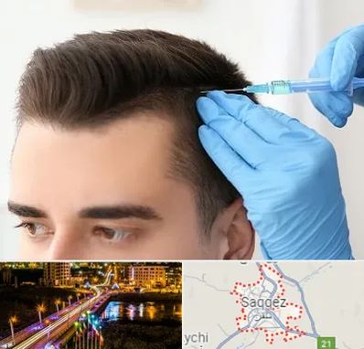 مزوتراپی مو در سقز