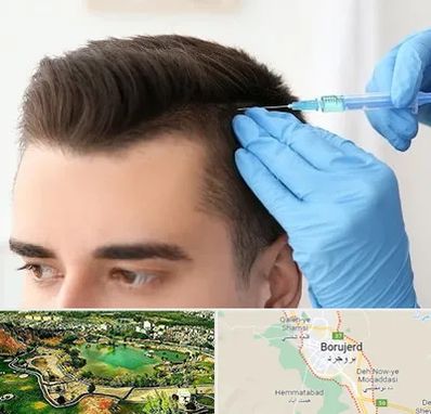 مزوتراپی مو در بروجرد