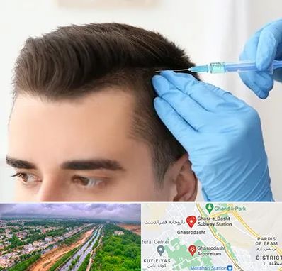 مزوتراپی مو در قصرالدشت شیراز