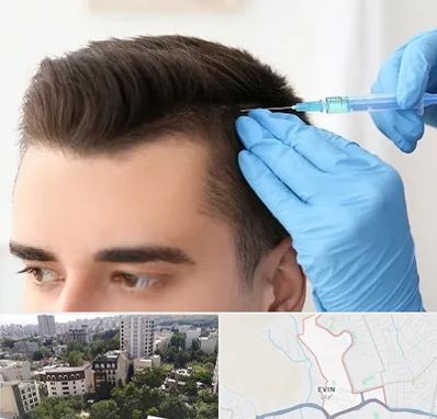 مزوتراپی مو در اوین