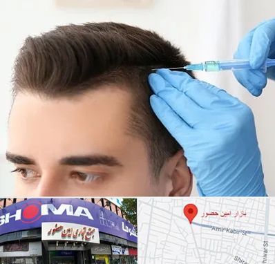 مزوتراپی مو در امین حضور