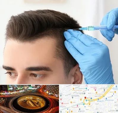 مزوتراپی مو در میدان ولیعصر