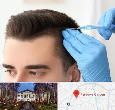 مزوتراپی مو در باغ فردوس