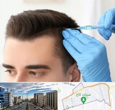 مزوتراپی مو در سعادت آباد تهران