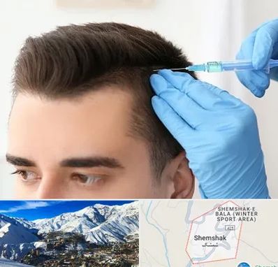 مزوتراپی مو در شمشک