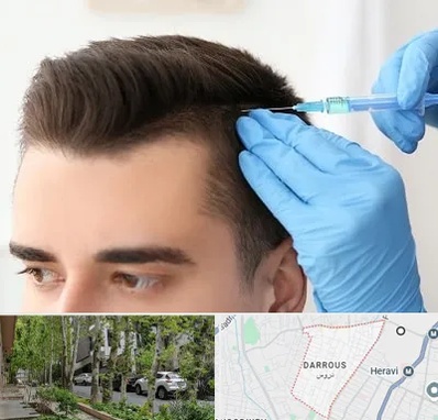 مزوتراپی مو در دروس
