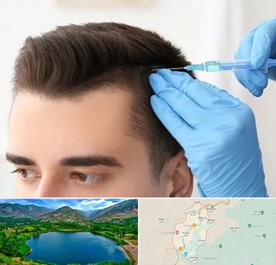 مزوتراپی مو در رودبار