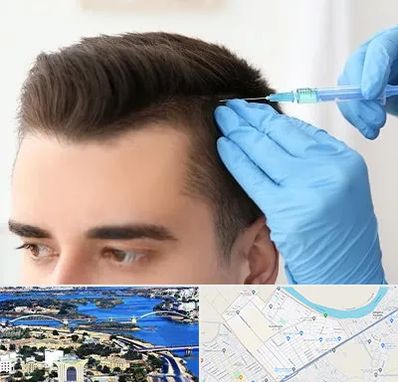 مزوتراپی مو در کوروش اهواز