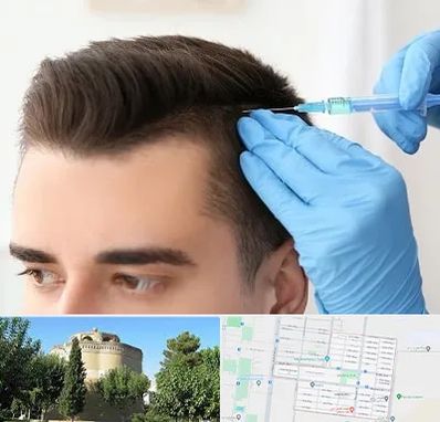 مزوتراپی مو در مرداویج اصفهان