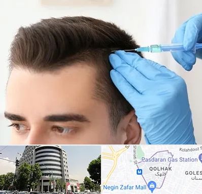 مزوتراپی مو در قلهک