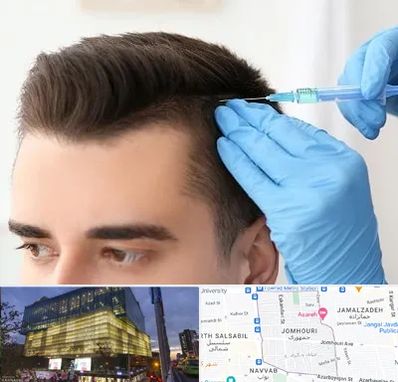 مزوتراپی مو در جمهوری