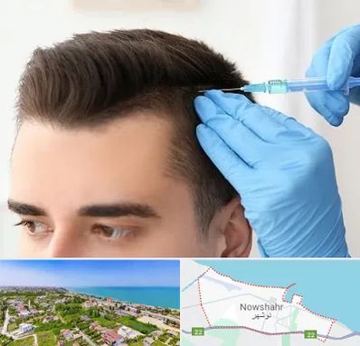 مزوتراپی مو در نوشهر