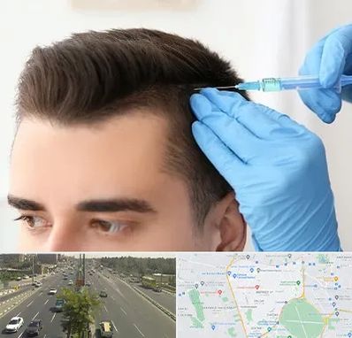 مزوتراپی مو در منطقه 17 تهران