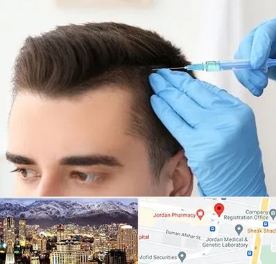 مزوتراپی مو در جردن