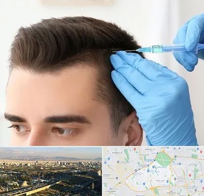 مزوتراپی مو در منطقه 19 تهران