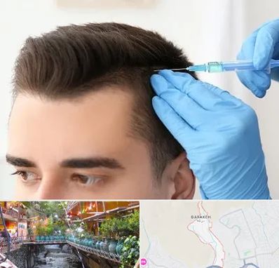 مزوتراپی مو در درکه