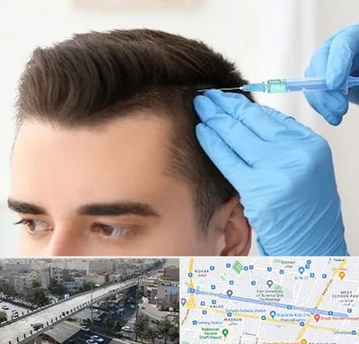 مزوتراپی مو در فرجام