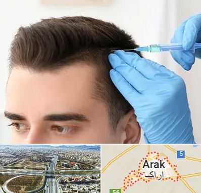 مزوتراپی مو در اراک