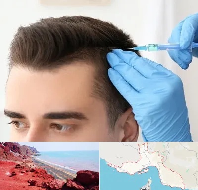 مزوتراپی مو در هرمزگان