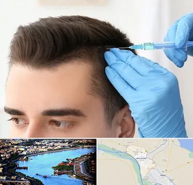 مزوتراپی مو در خرمشهر