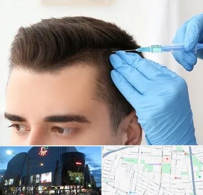 مزوتراپی مو در بلوار اباذر