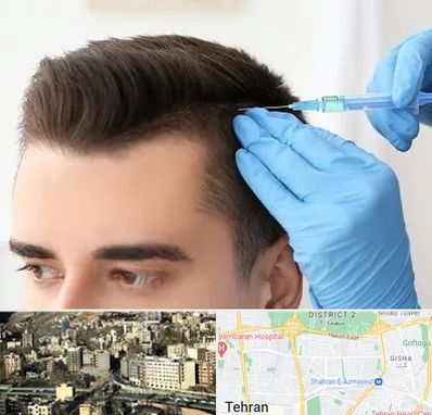 مزوتراپی مو در مرزداران