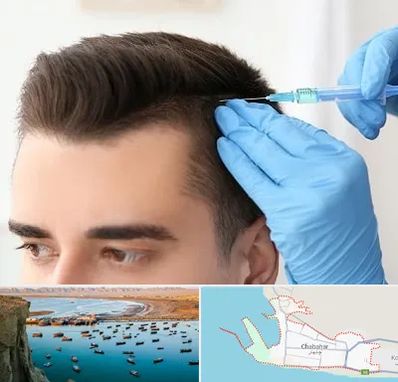 مزوتراپی مو در چابهار
