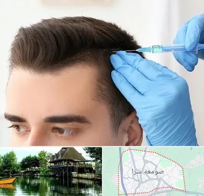 مزوتراپی مو در صومعه سرا