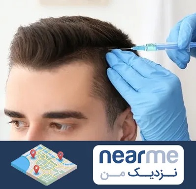 مزوتراپی مو در نزدیک من