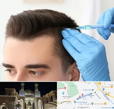 مزوتراپی مو در زرگری شیراز