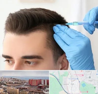 مزوتراپی مو در سهند تبریز