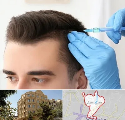 مزوتراپی مو در مینی سیتی