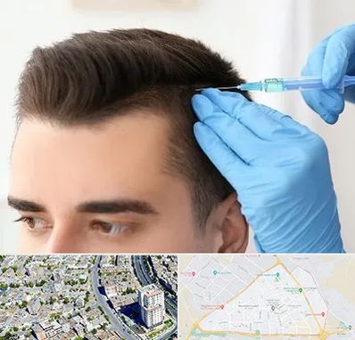 مزوتراپی مو در قاسم آباد مشهد