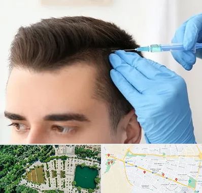 مزوتراپی مو در وکیل آباد مشهد