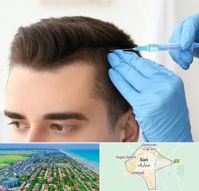 مزوتراپی مو در ساری