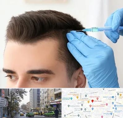 مزوتراپی مو در فاطمی