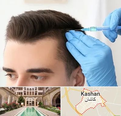 مزوتراپی مو در کاشان