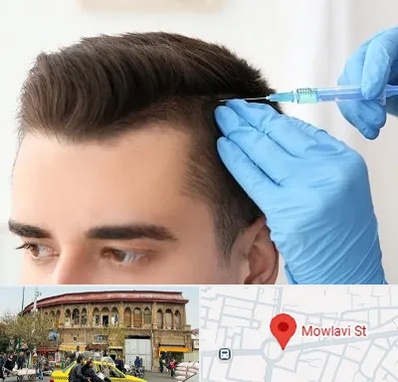 مزوتراپی مو در مولوی