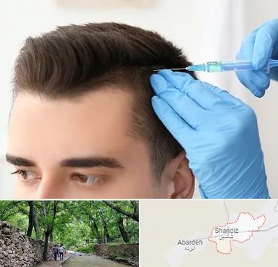 مزوتراپی مو در شاندیز مشهد