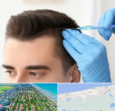 مزوتراپی مو در فریدونکنار