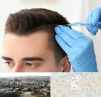 مزوتراپی مو در منطقه 20 تهران