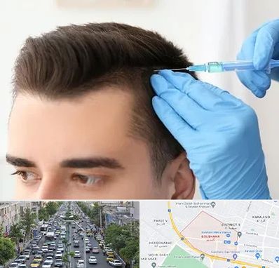 مزوتراپی مو در گلشهر کرج