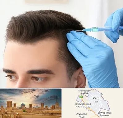 مزوتراپی مو در یزد